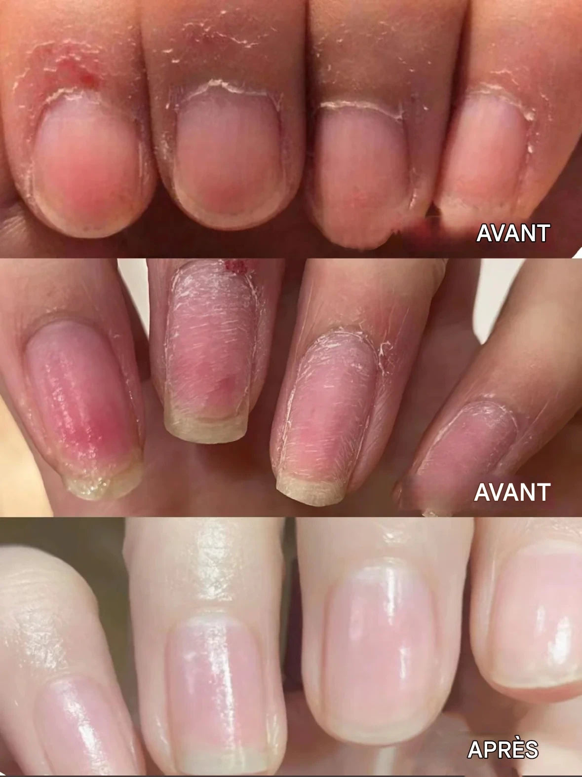 đ2025 Nouveau stylo de soin des ongles 3 en 1 amĂ©liorĂ©đ