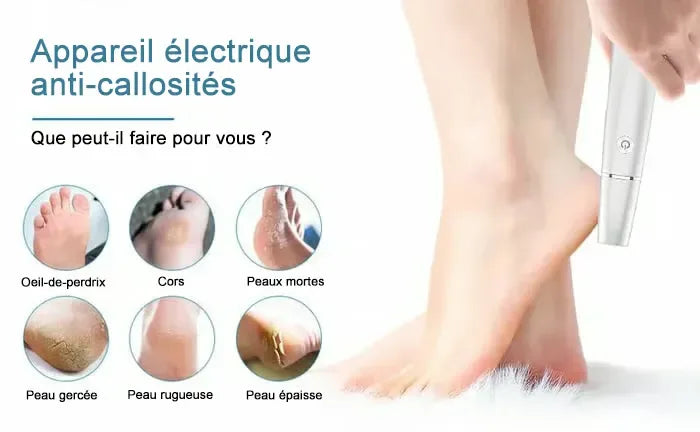 Éliminateur électrique de callosités pour les pieds