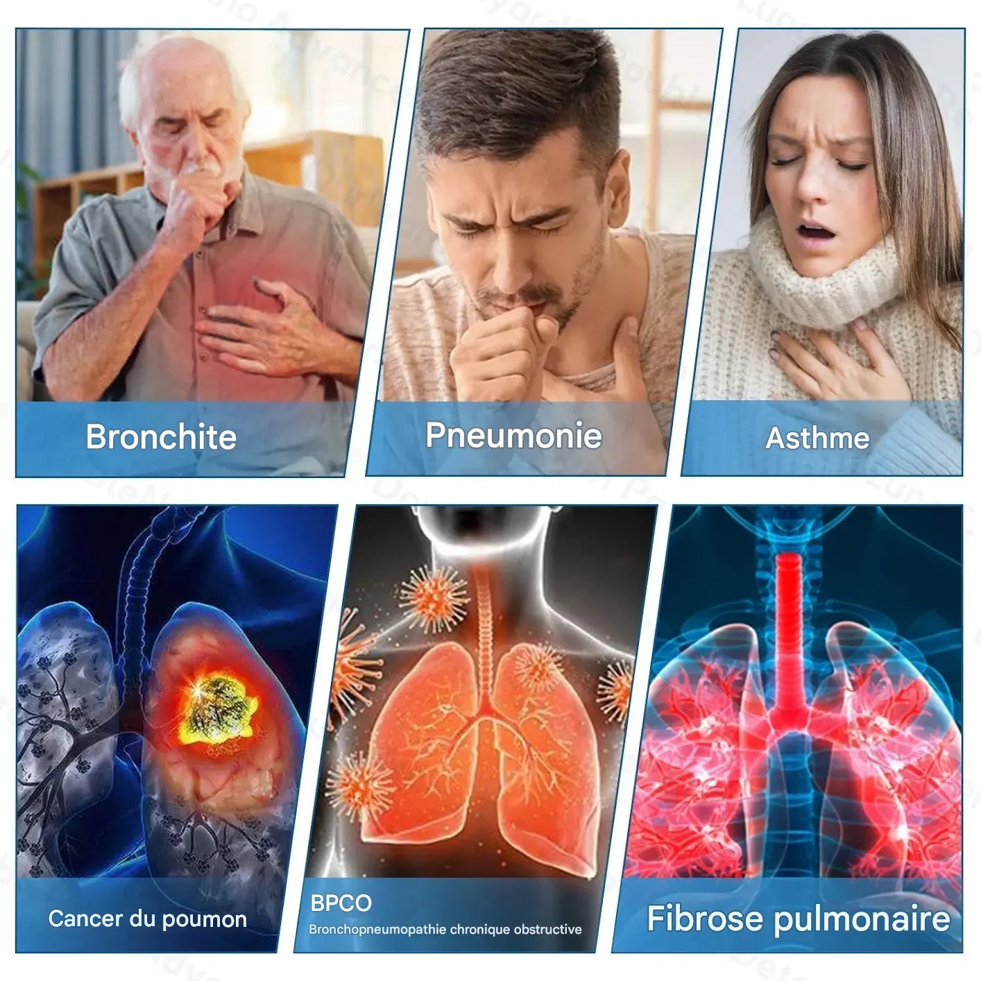 Patch Corps Doux â Soulagement Quotidien et Soin Nourrissant pour Votre Peau