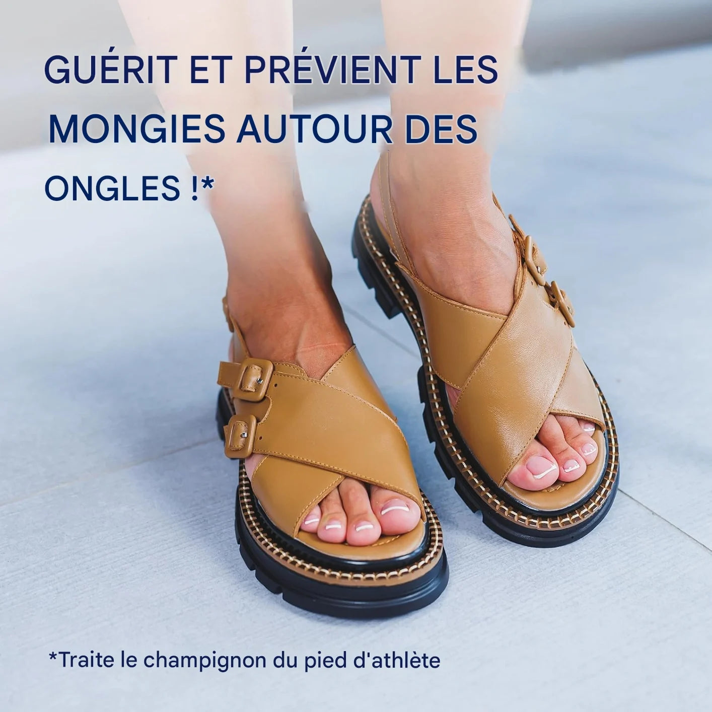 Éliminez les champignons, révélez la beauté naturelle de vos ongles !