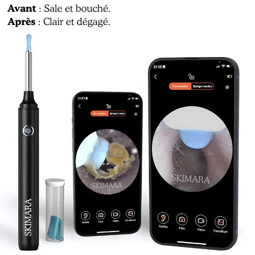 Oreilles bouchées ? Démangeaisons ? Skimara™ Pro les élimine en 1 min, sans risque.