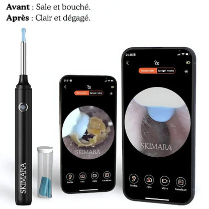 Oreilles bouchées ? Démangeaisons ? Skimara™ Pro les élimine en 1 min, sans risque.