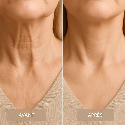 Bande de lifting pour le visage et le cou