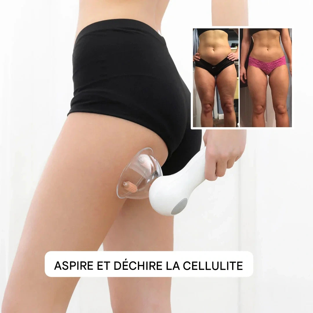 Massager Anti-Cellulite Portable – Minceur et Raffermissement par Thérapie par Vide