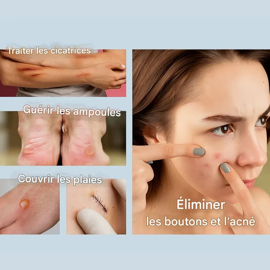 Traitement hydrocolloïde