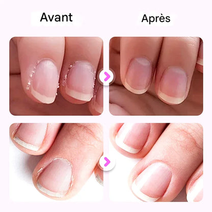 💜2025 Nouveau stylo de soin des ongles 3 en 1 amélioré💅
