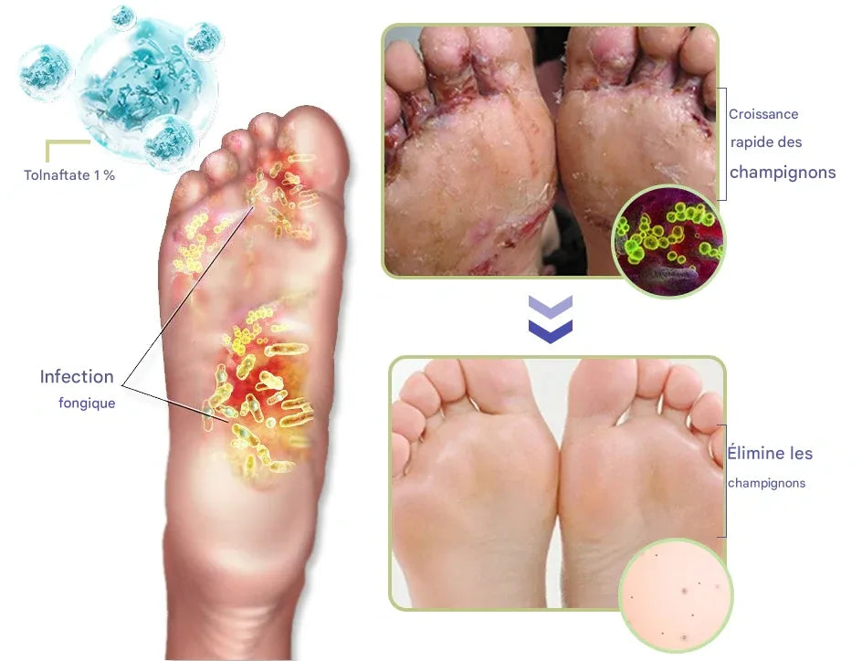 ✨ Des Pieds Doux, Frais et Sans Odeur – Découvrez le Secret du Soin Quotidien Ximen ! ✨