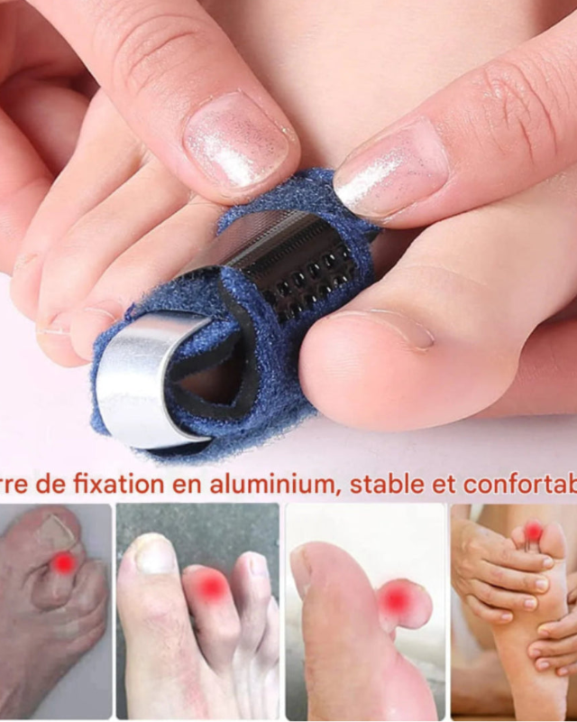 Attelle Correctrice pour Orteils – Soulagement et Alignement Instantané