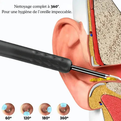 Oreilles bouchées ? Démangeaisons ? Skimara™ Pro les élimine en 1 min, sans risque.