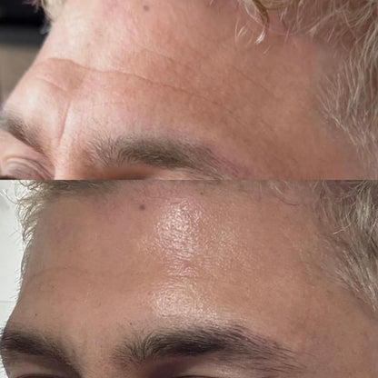 Patchs Visage Anti-Rides Réutilisables