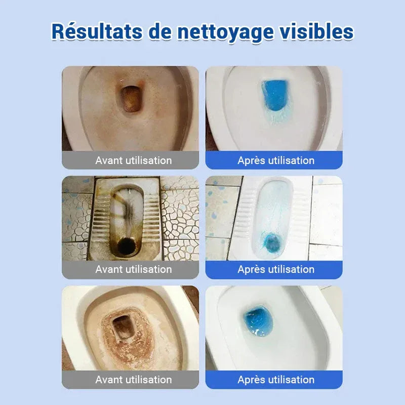 ✨ Comprimés effervescents de nettoyage des toilettes - décontamination, tartre urinaire, alcali urinaire et élimination des odeurs