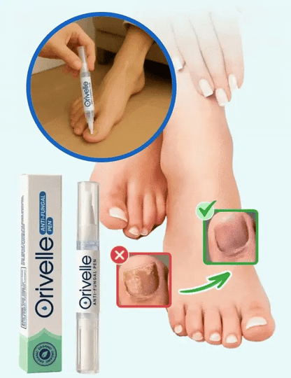 Une méthode naturelle pour éliminer définitivement les mycoses des ongles