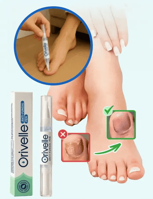 Une méthode naturelle pour éliminer définitivement les mycoses des ongles