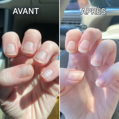 Nail Nutrient Oil Pen