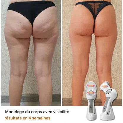 Massager Anti-Cellulite Portable – Minceur et Raffermissement par Thérapie par Vide