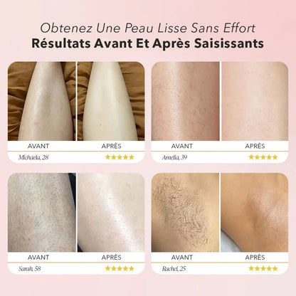 Vivena™ Tondeuse 2.0